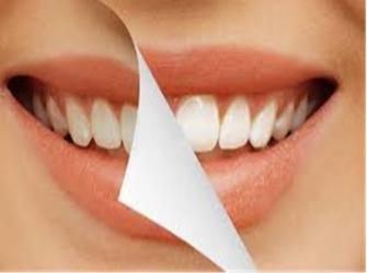 Aprenda como clarear os dentes de forma simples e barata