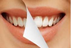 Aprenda como clarear os dentes de forma simples e barata