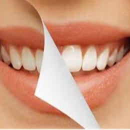 Aprenda como clarear os dentes de forma simples e barata