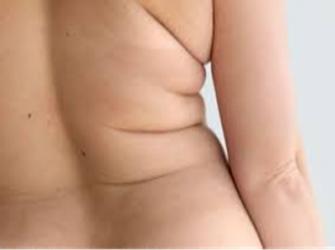 5 alimentos que ajudam a tirar os pneuzinhos
