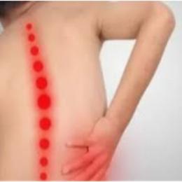 Nódulo de Schmorl - fraqueza da placa vertebral
