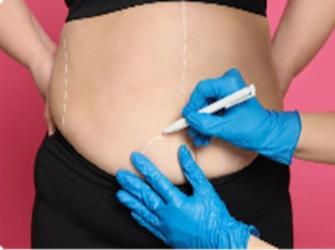 Cirurgia bariátrica deve ser o último recurso contra a obesidade