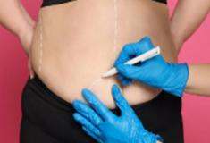 Cirurgia bariátrica deve ser o último recurso contra a obesidade